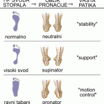 svod pronacija patike 150x150 Patike za trčanje