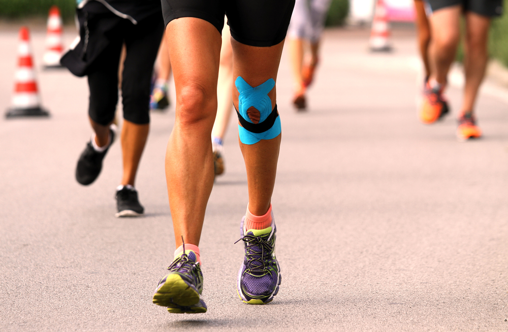 ITBS – sindrom trenja iliotibijalne trake (Iliotibial band syndrome)